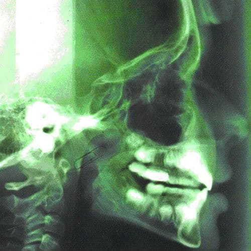 Album cover art for Aivan Kuin Kaikki Muutkin