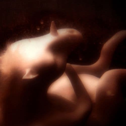 Album cover art for Young Tender Hearts Beat Fast