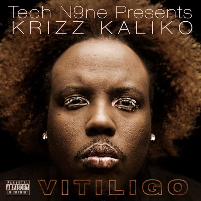 Album cover art for Vitiligo